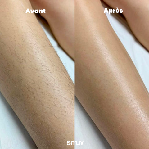 Smuv Perfect Skin